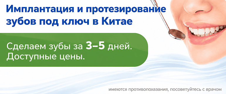 Имплантация и протезирование зубов под ключ в Китае