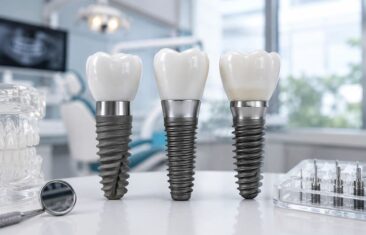 Osstem, Dentium и Straumann — сравнение современных систем зубных имплантов